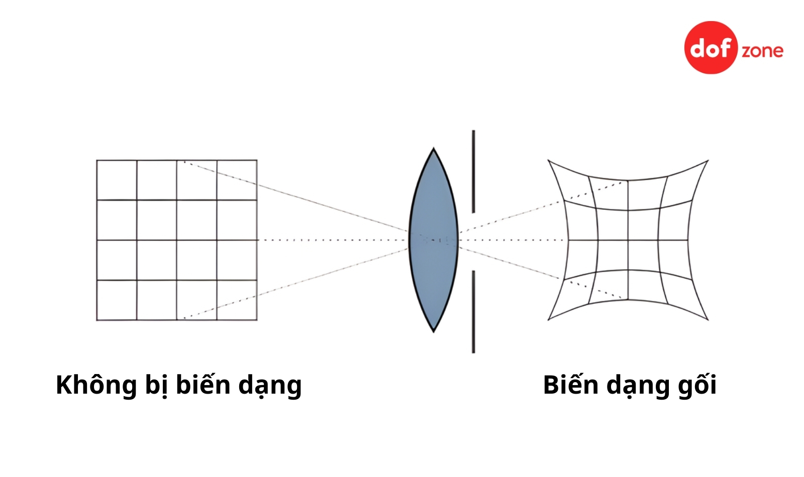 Bien-dang-ong-kinh-la-gu-Phan-loai-va-cach-khac-phuc-7.jpg